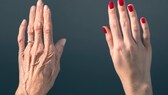 Eine ketogene Ernährung könnte das biologische Alter positiv beeinflussen