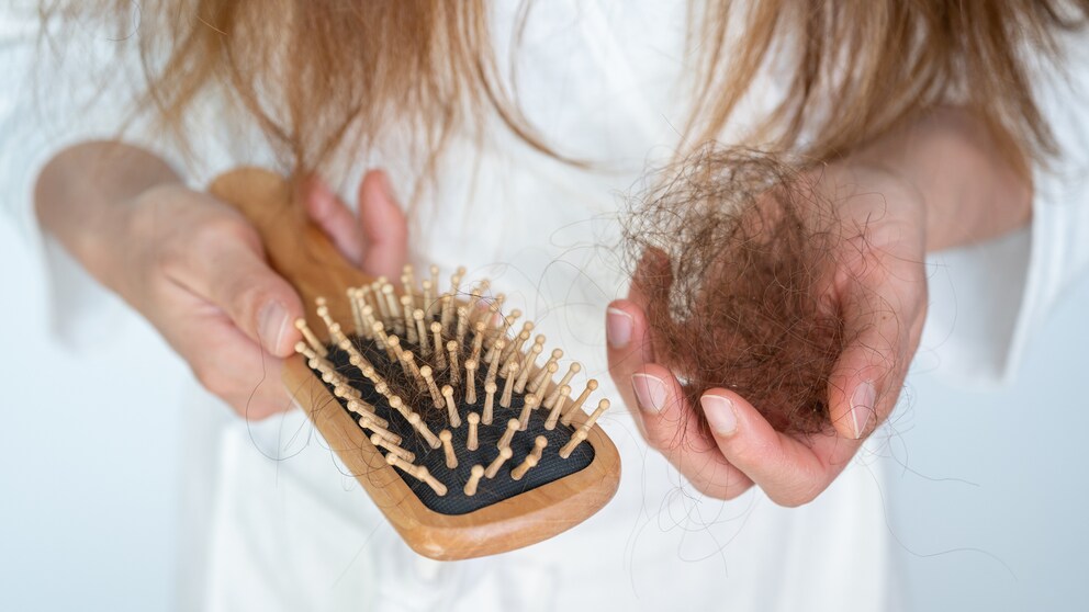 Äußerlich ist ein Vitamin-B12-Mangel etwa durch Haarausfall oder spröde Nägel sichtbar. Doch auch Symptome wie Müdigkeit und  Konzentrationsschwäche können auf einen Mangel hindeuten.