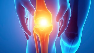 Was sollten Menschen mit Arthrose bei ihrer Ernährung beachten?