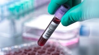 Ein neuer Bluttest soll zeigen, wie alt man wirklich ist