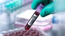 Ein neuer Bluttest soll zeigen, wie alt man wirklich ist