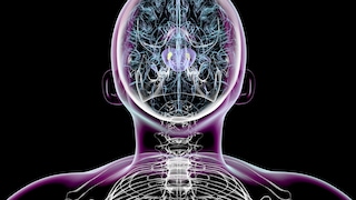 Parkinson