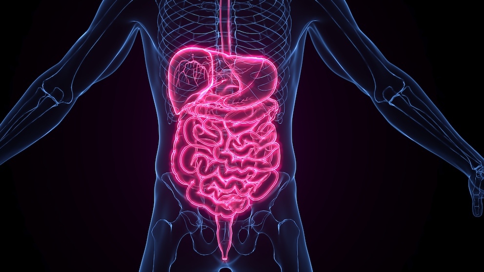Ständig Bauchschmerzen, Blähungen und Durchfall? Dann könnten Sie vom Leaky-Gut-Syndrom betroffen sein.