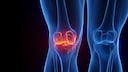 Schleimbeutelentz&uuml;ndungen, auch Bursitis genannt, f&uuml;hren zu starken Gelenkschmerzen
