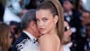 Topmodel Barbara Palvin teilte ihre Endometriose-Leidensgeschichte auf Instagram