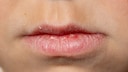 Farbver&auml;nderungen der Lippen k&ouml;nnen warnen. Was bl&auml;uliche, spr&ouml;de oder fahle Lippen bedeuten k&ouml;nnen.