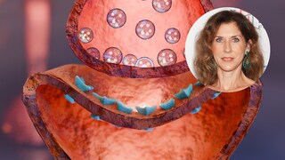 Monica Seles macht Myasthenie-Diagnose bekannt