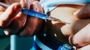 Eine neue Studie liefert Hinweise zu einer weiteren m&ouml;glichen ernsthaften Nebenwirkung von Semaglutid