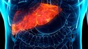 Eine Fettleber kann schmerzlos sein, sollte aber unbedingt behandelt werden, falls eine Erkrankung vorliegt