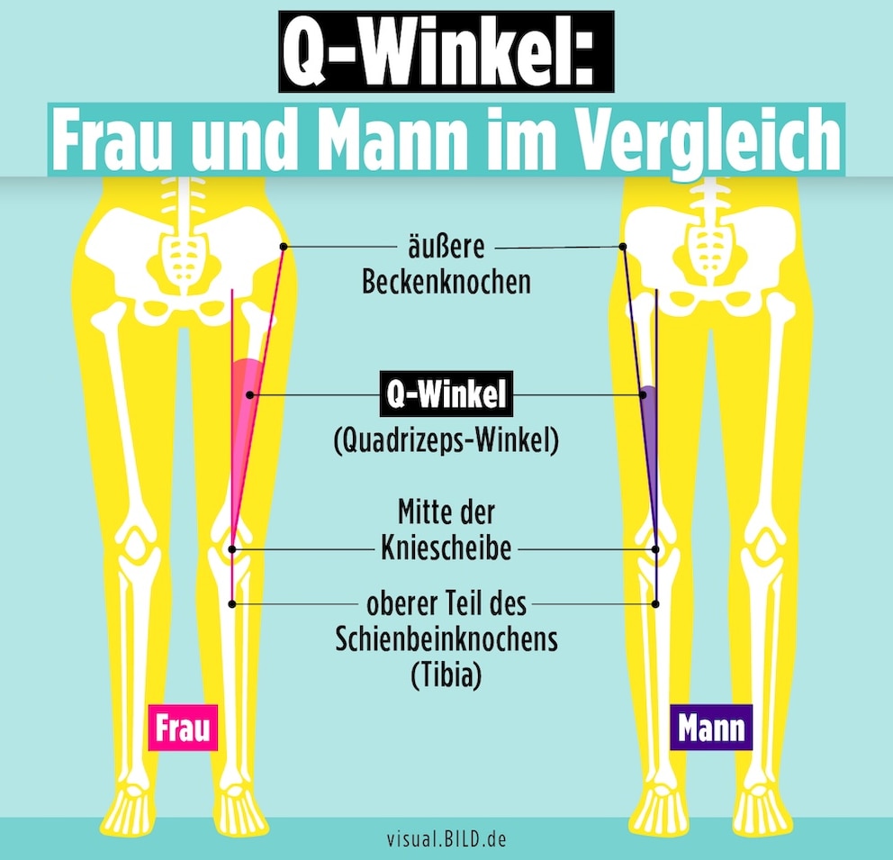 Q-Winkel