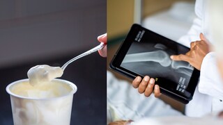 Joghurt und Knochengesundheit – Studie
