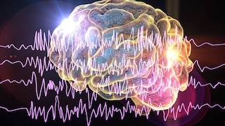Epileptischer Anfall