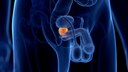 Eine Studie hat untersucht, wie sich das Prostatakrebsrisiko senken l&auml;sst