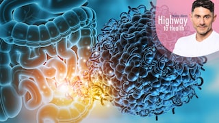 Eine hochwertige Ernährung kann das Darmmikrobiom in eine Richtung verschieben, die mit günstigeren Gesundheitswerten verbunden ist
