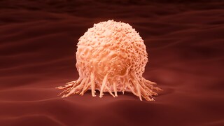 Farbenblindheit hat einen erstaunlichen Zusammenhang mit Blasenkrebs