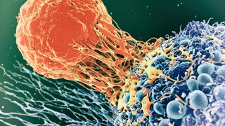 Es gibt offenbar einen Zusammenhang zwischen Keto-Diät und Leberkrebs