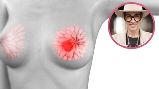 Swaantje Taube berichtet über ihren Brustkrebs