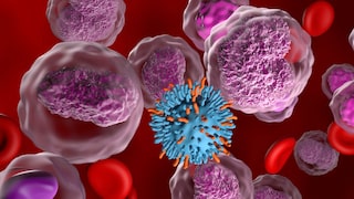 Krebs kann u. a. mit Ernährung zusammenhängen