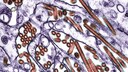 Vogelgrippevirus vom Typ H5N1