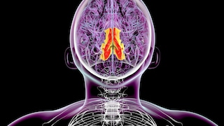 Bei Epilepsie kommt es infolge einer übermäßigen Aktivität von Nervenzellen im Gehirn zu plötzlich auftretenden Krampfanfällen.