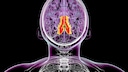 Bei Epilepsie kommt es infolge einer &uuml;berm&auml;&szlig;igen Aktivit&auml;t von Nervenzellen im Gehirn zu pl&ouml;tzlich auftretenden Krampfanf&auml;llen.
