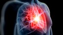 Studie zu Herzinfarkt und Rauchen