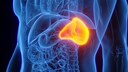 Leberfibrose und Alkohol