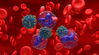 PFAS stehen womöglich in Verbindung mit Leukämie