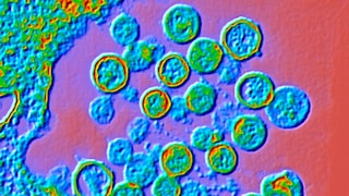 Das Hantavirus wird oft von Nagetieren auf den Menschen übertragen und kann je nach Virusstamm verschiedene Krankheitsverläufe hervorrufen.