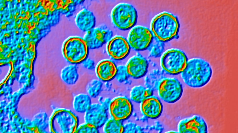 Das Hantavirus wird oft von Nagetieren auf den Menschen übertragen und kann je nach Virusstamm verschiedene Krankheitsverläufe hervorrufen.