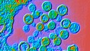 Das Hantavirus wird oft von Nagetieren auf den Menschen &uuml;bertragen und kann je nach Virusstamm verschiedene Krankheitsverl&auml;ufe hervorrufen.