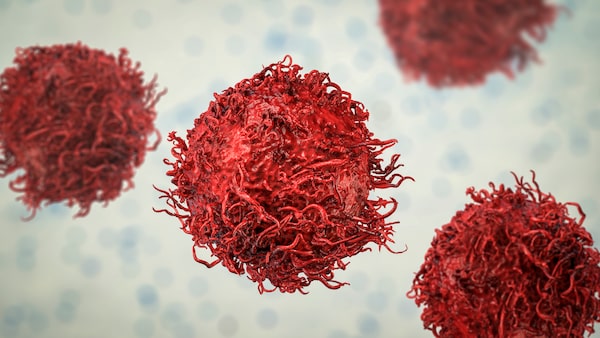 Studie zu Krebs bei jüngeren Erwachsenen