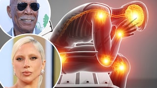 Fibromyalgie