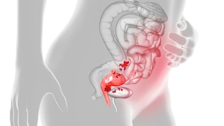 Bestimmte Lebensmittel sind laut Expertin gut für Fauen in den Wechseljahren