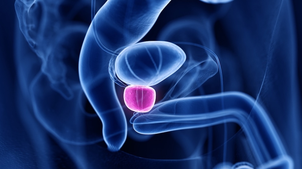 prostata