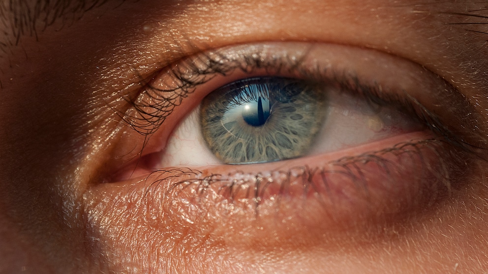 Kann das Auge einen Hinweis auf das Hautkrebsrisiko geben?