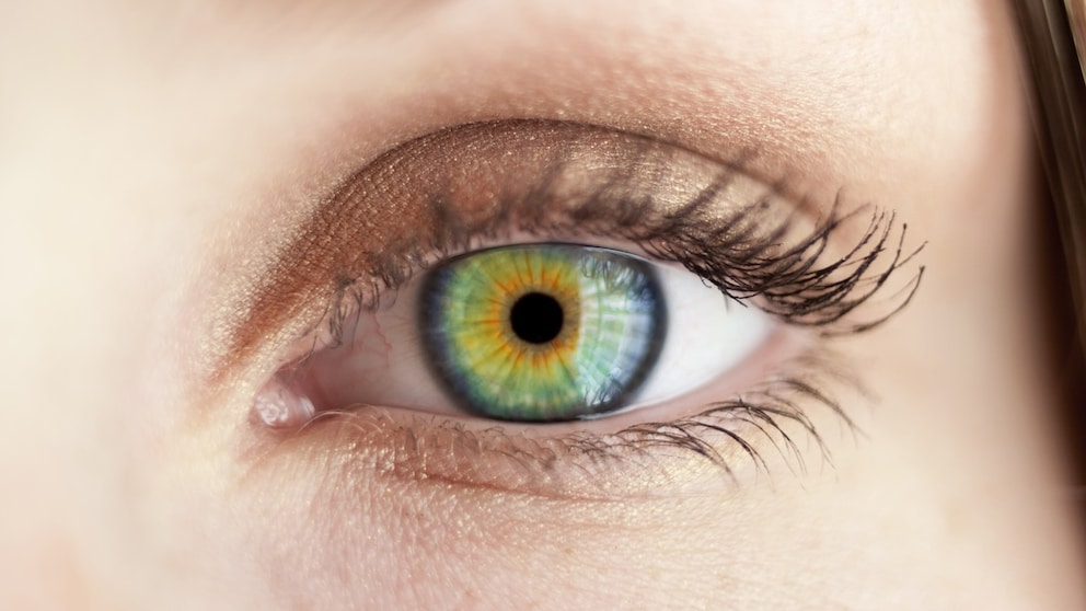 Pterygium ist eine Wucherung im Auge, die jetzt mit Hautkrebs in Verbindung gebracht wurde