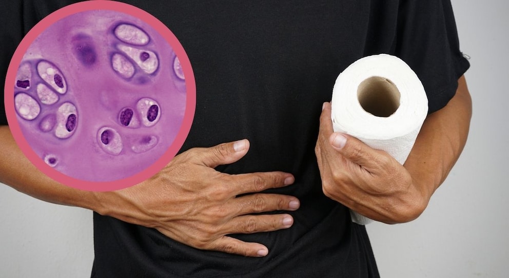 Cyclospora cayetanensis l&ouml;st explosiven Durchfall aus