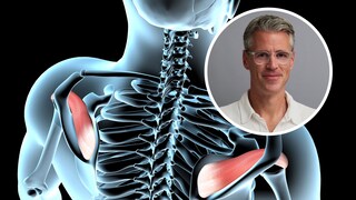 3 Übungen, die ich als Orthopäde im Gym meide