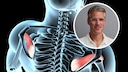 3 &Uuml;bungen, die ich als Orthop&auml;de im Gym meide