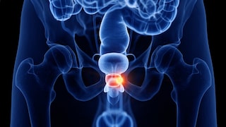 prostata