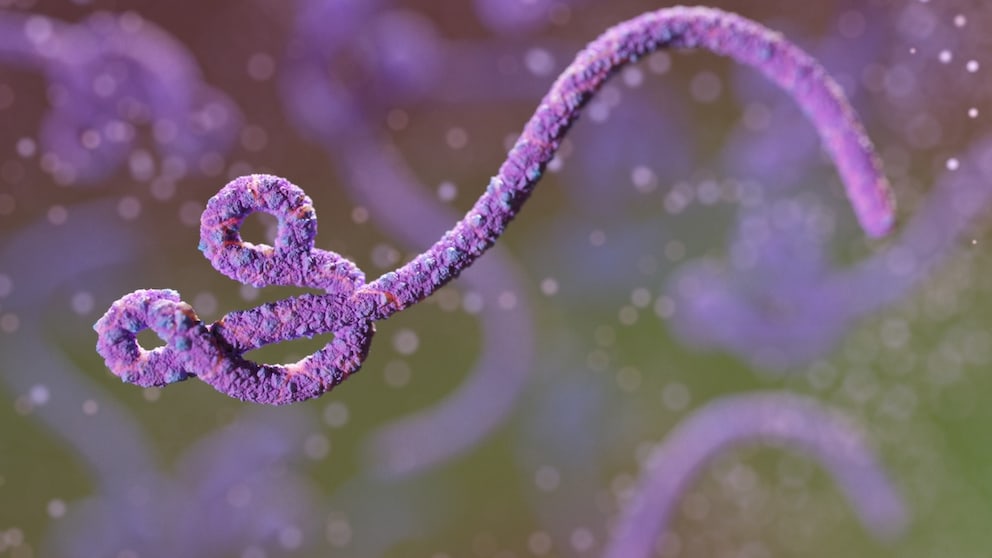 Ebola ist auch als Ebola-Viruskrankheit oder Ebolafieber bekannt