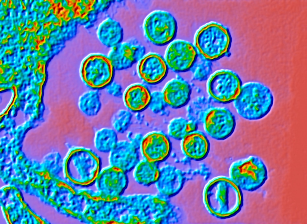 Mikroskopische Aufnahme des Hantavirus