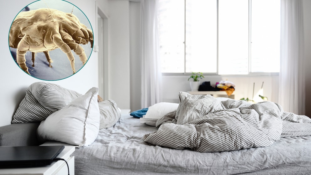 Hausstaubmilben hat jeder in der Wohnung. Sie leben unter anderem von Hautschuppen