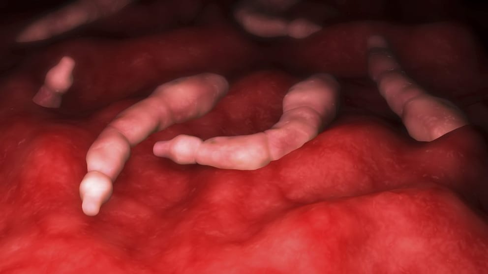Biomedical illustration: Fox tapeworms in liver tissue