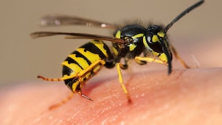 Wespe sticht in Haut