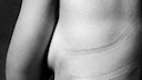 Nackte Frau BH-Abdruck