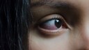 Frau mit rotem Auge