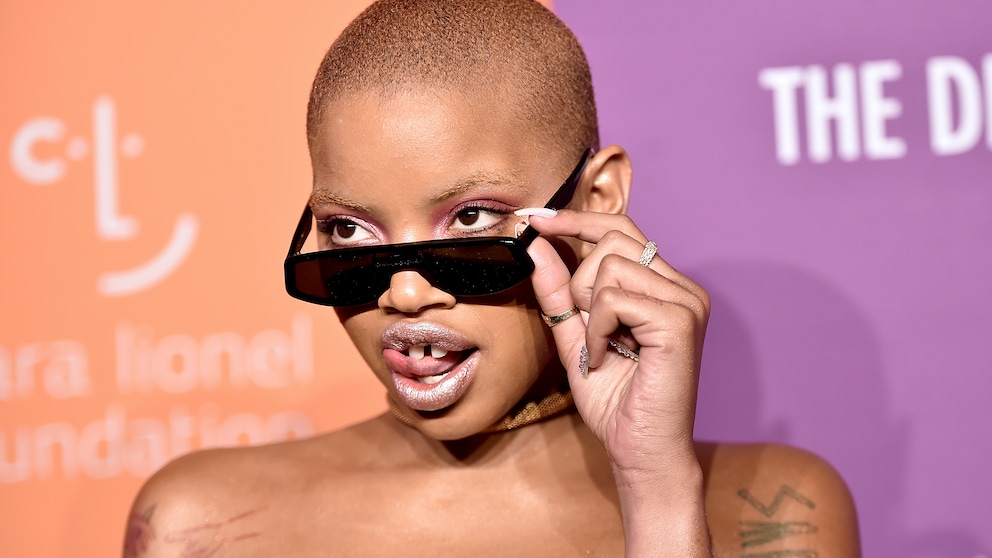 Slick Woods hautkrebs