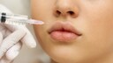Frau, die Filler in die Lippen gespritzt bekommt